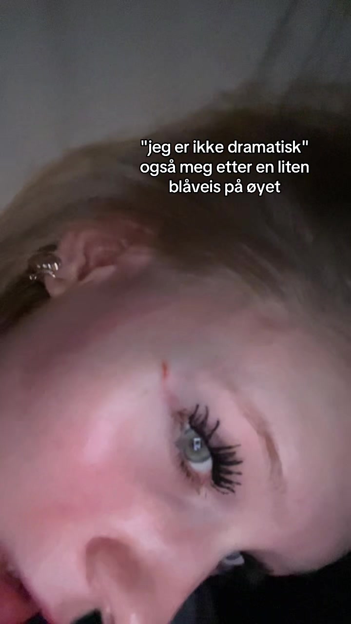 @AMALIE SYNN&Oslash;VE 🪽