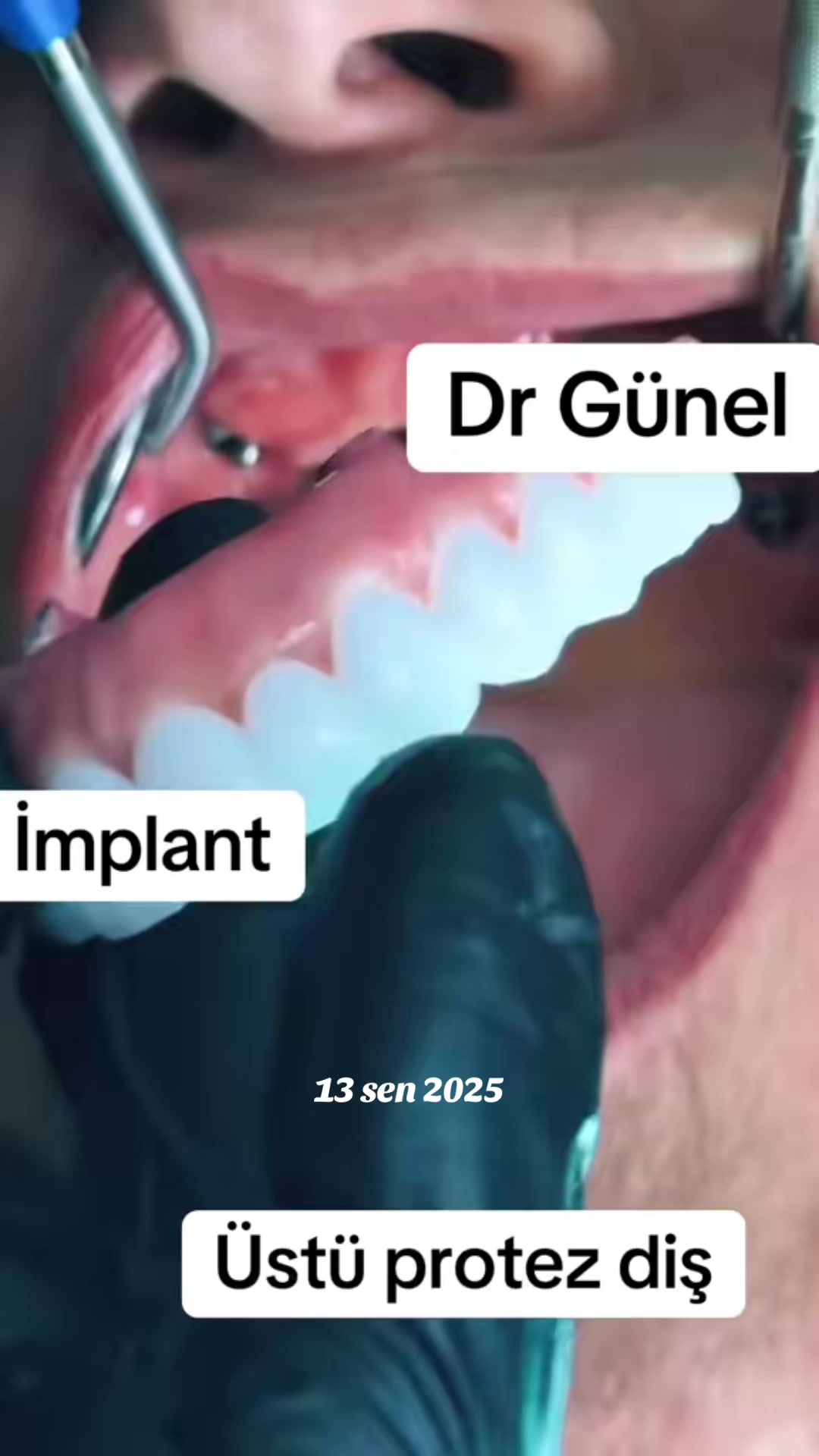 @Dentist_G&uuml;nel