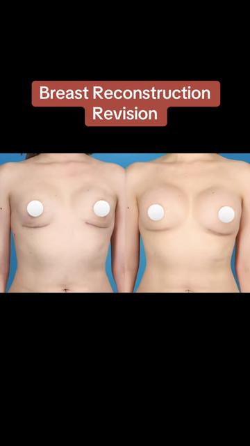 @Kelly Killeen, MD, FACS