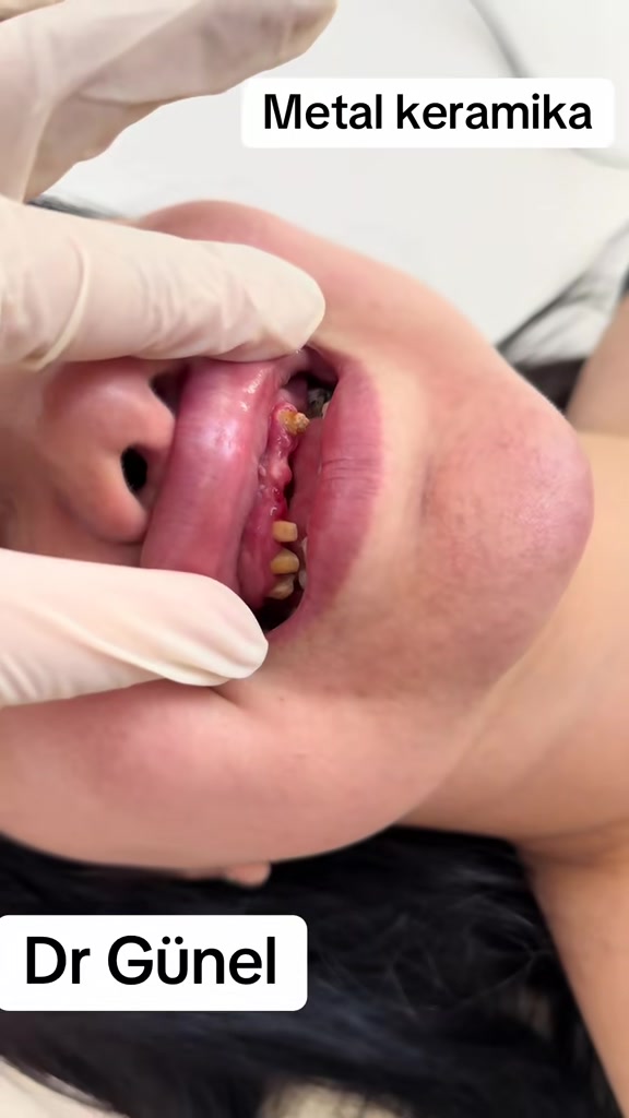 @Dentist_G&uuml;nel