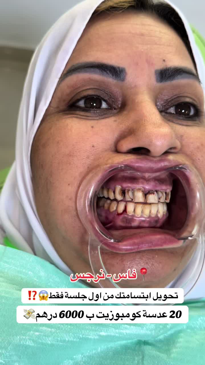 @brightsmileee1