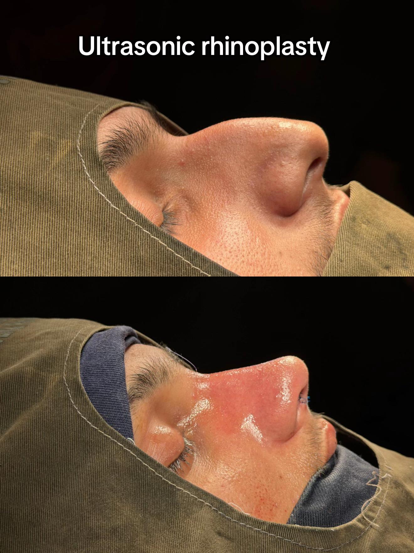 @Dr Ibrar ENT & Rhinoplasty