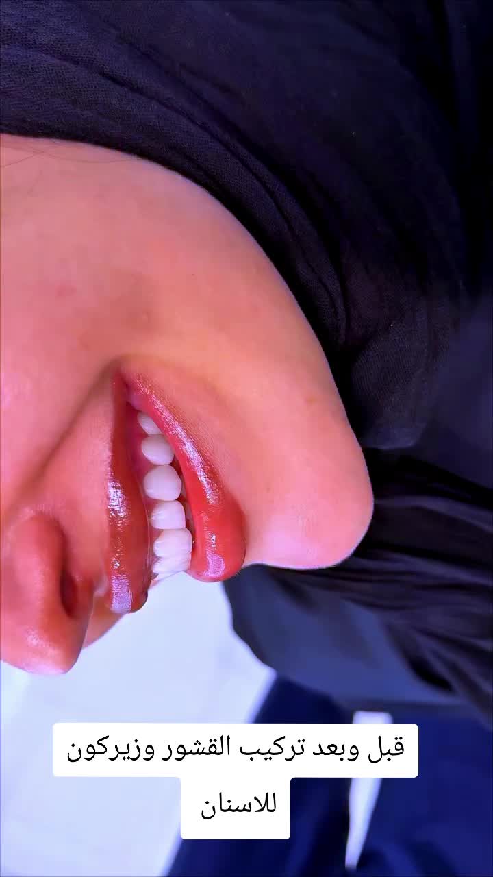 @Dr mohammad