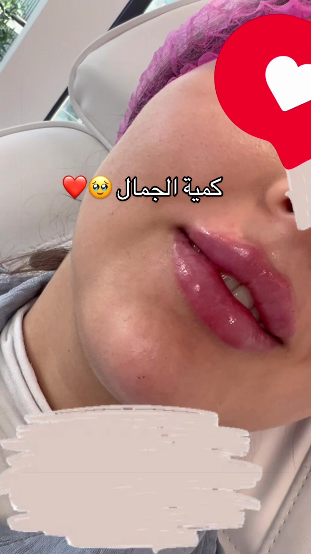 @Senséa Aesthetic clinic