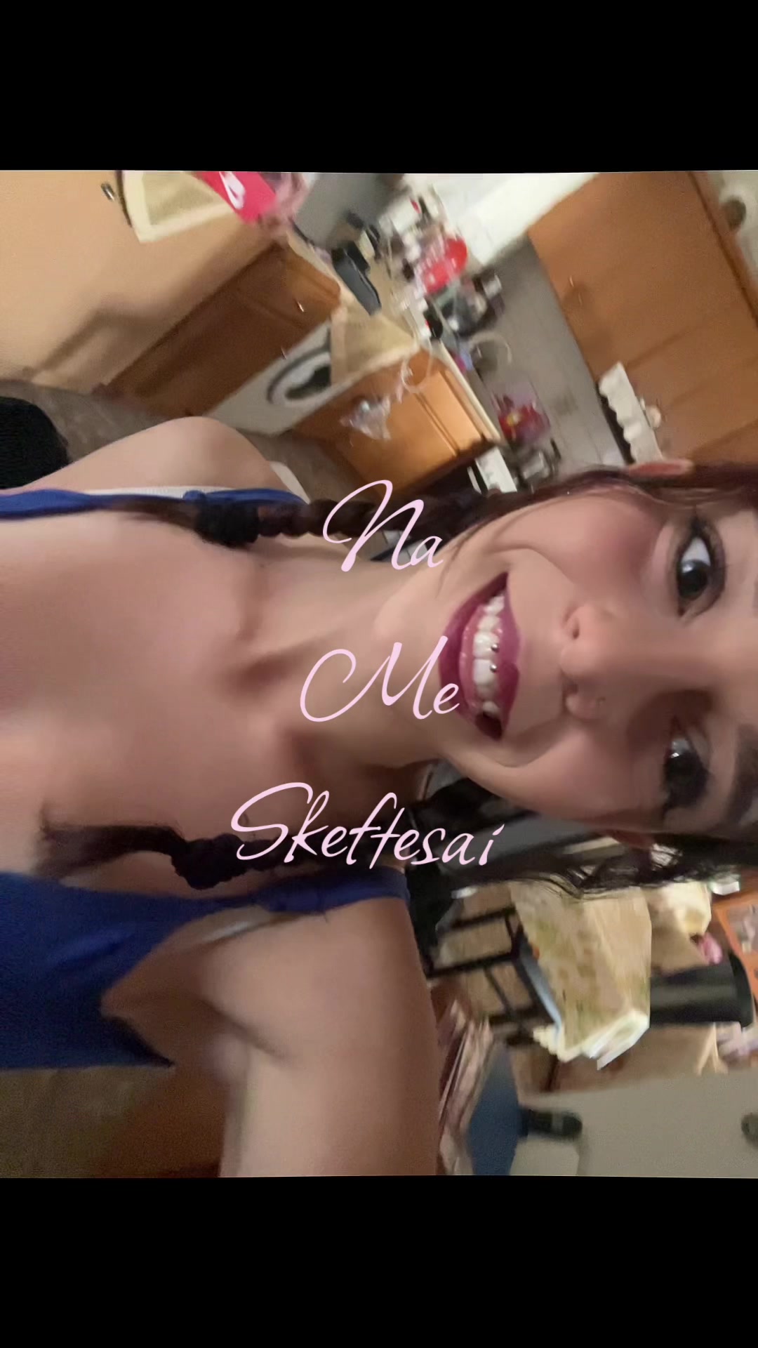 @🙊