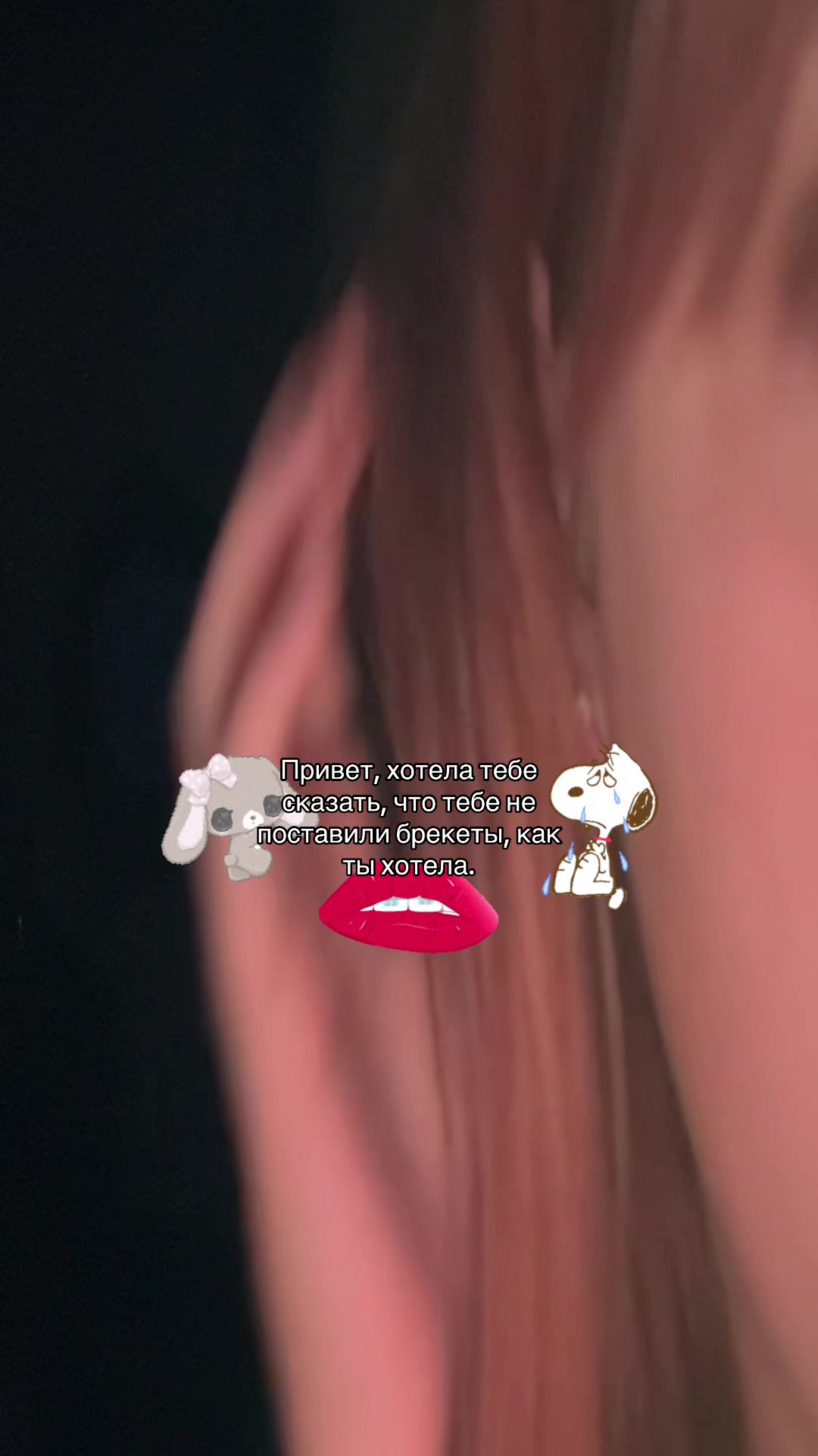 @fᴀnᴩᴀgᴇ|ʙrᴀᴄᴇs