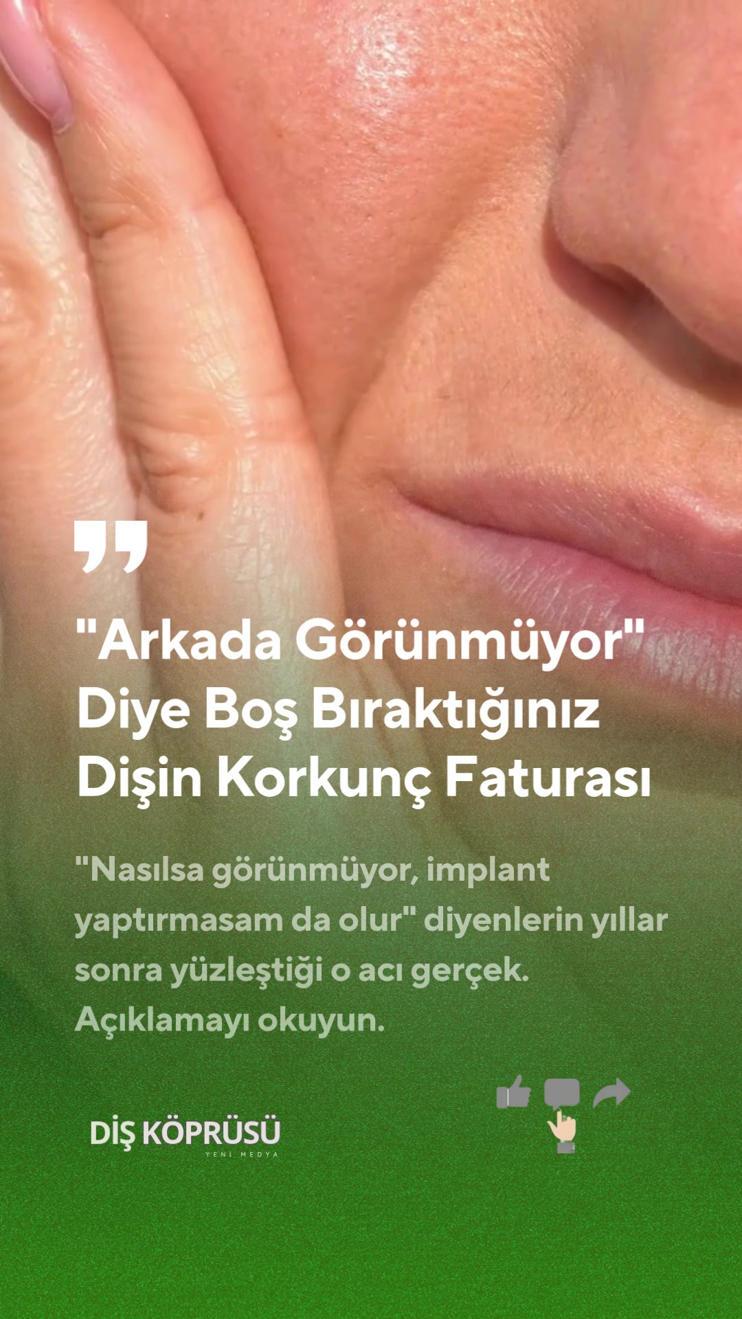 @Diş K&ouml;pr&uuml;s&uuml; | Yeni Medya