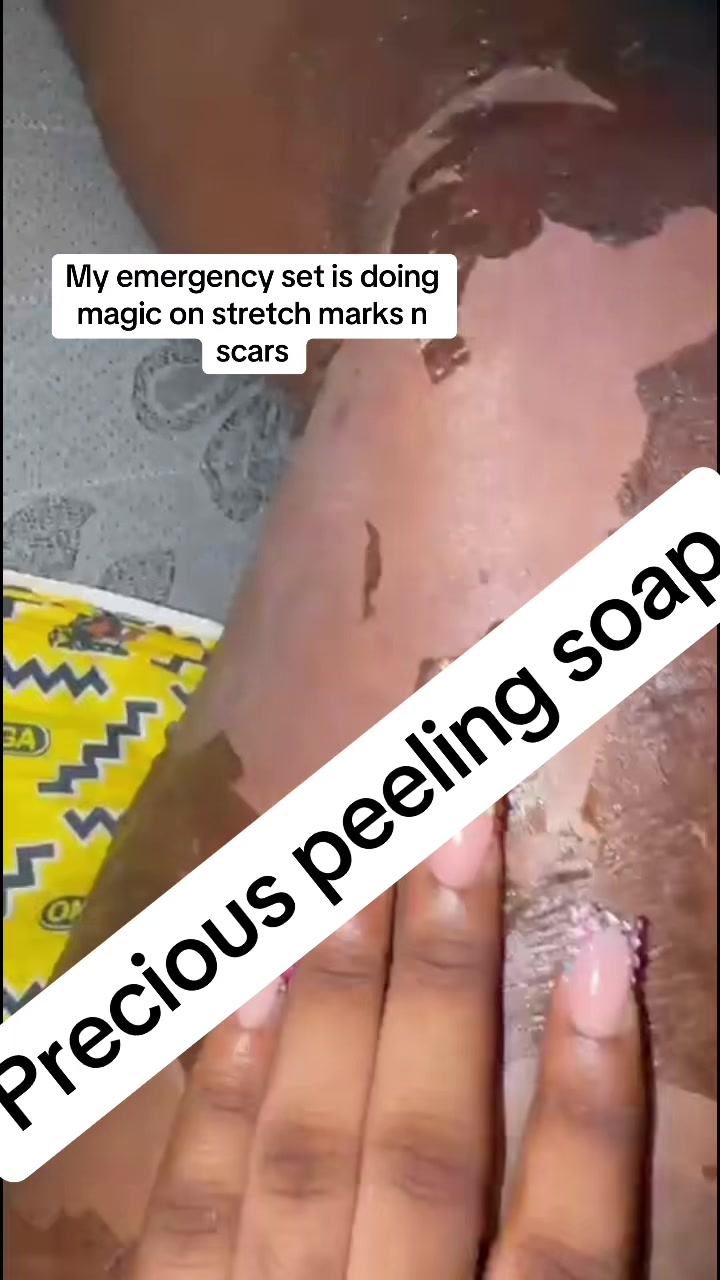 @@ Precious peeling soap