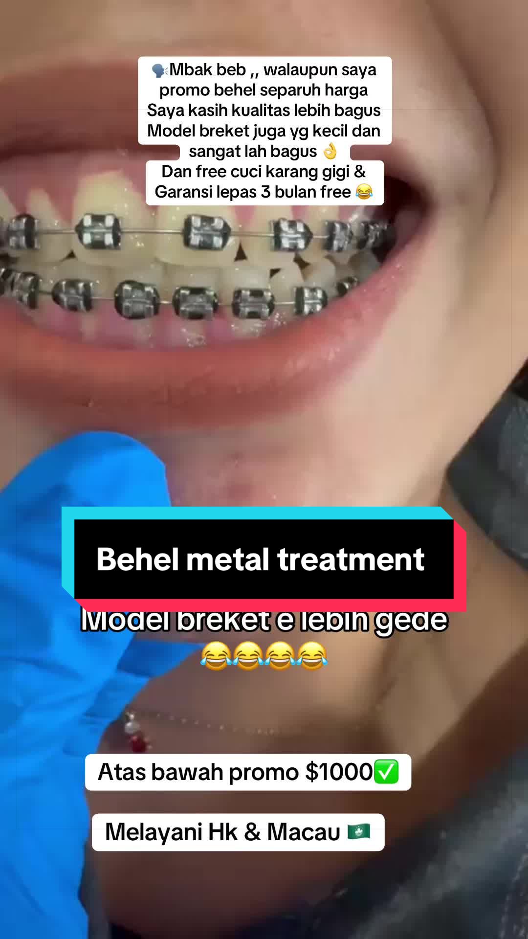 @mbak-Paijem