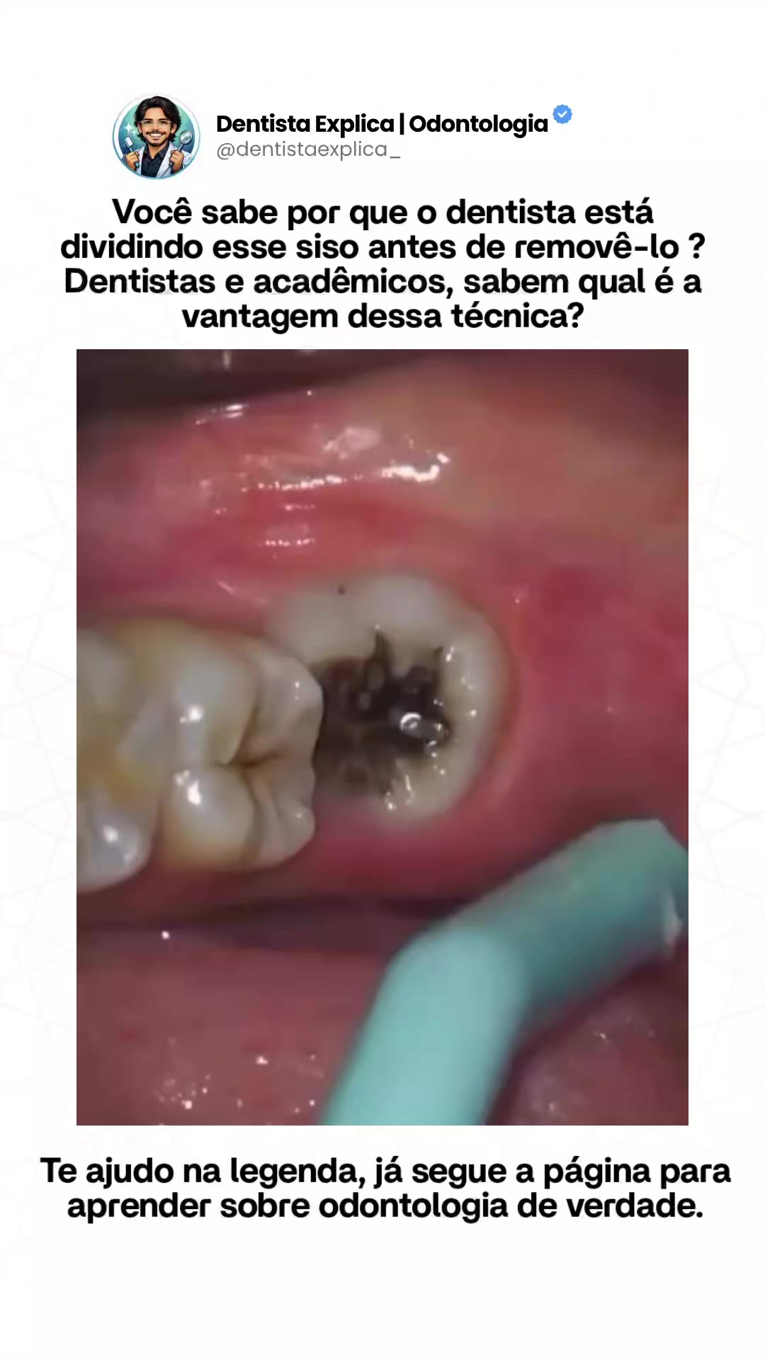 @Dentista Explica | Odontologia