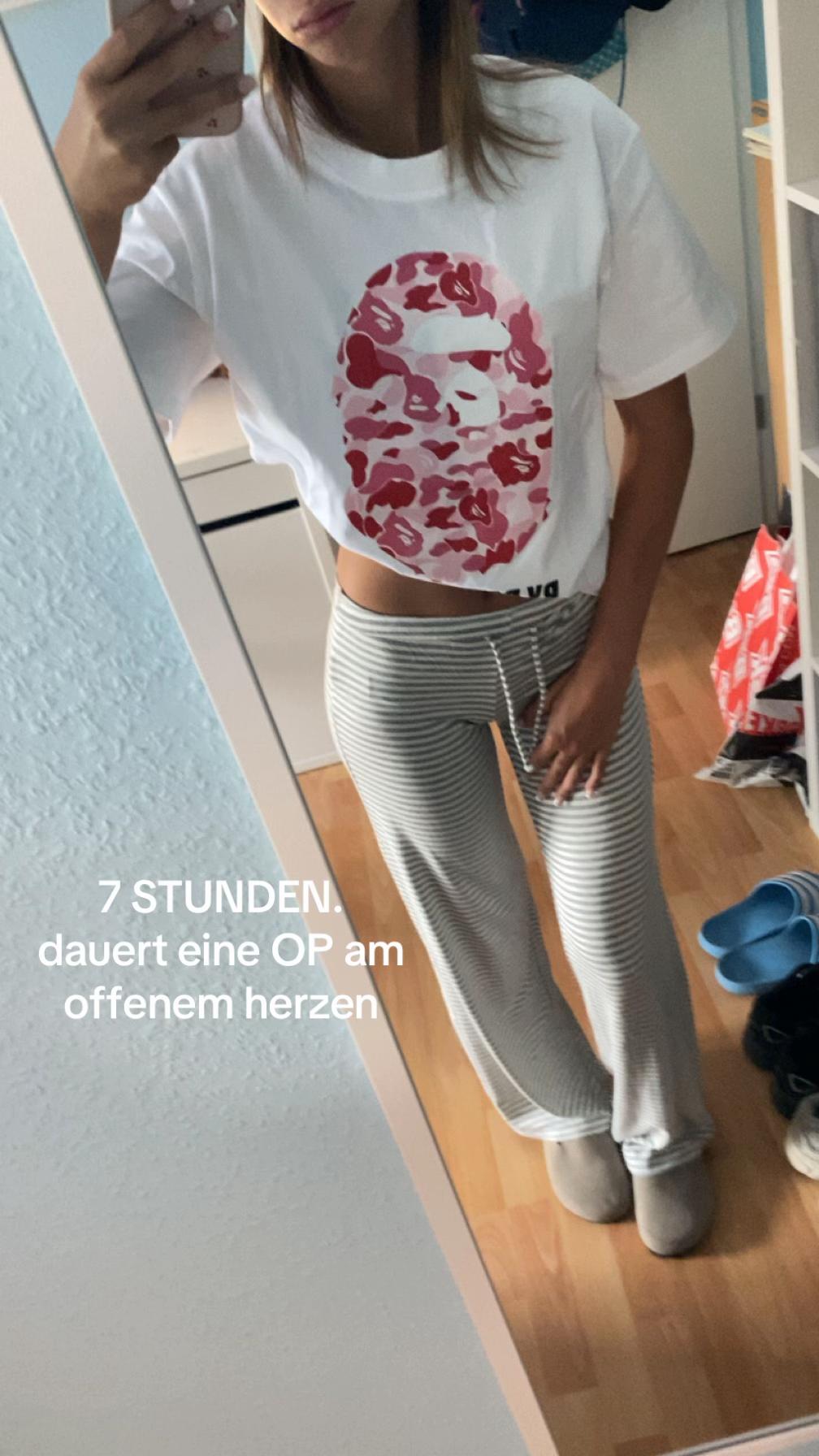 @F‘🪼