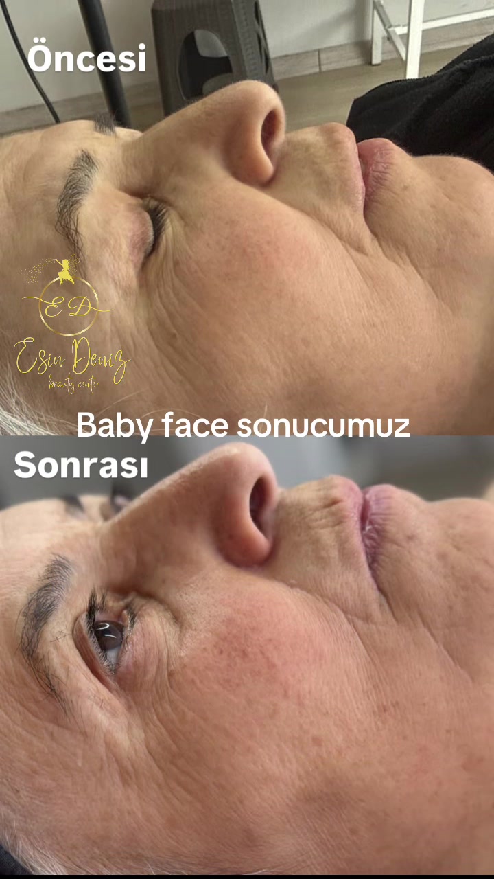 @Esin Deniz Beauty center