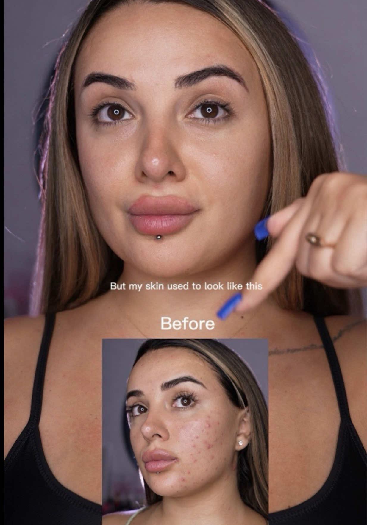 @t1nano