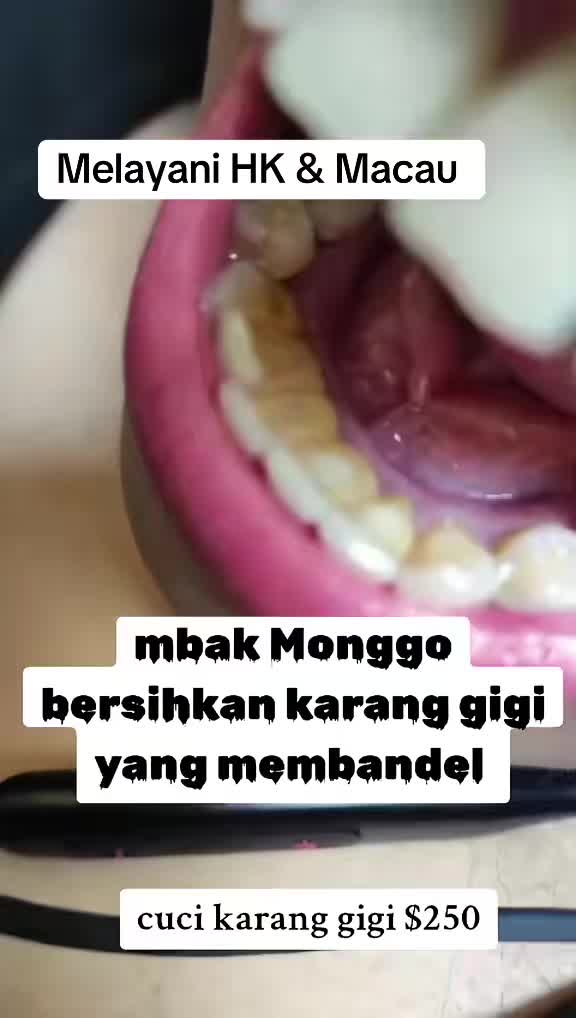 @mbak-Paijem