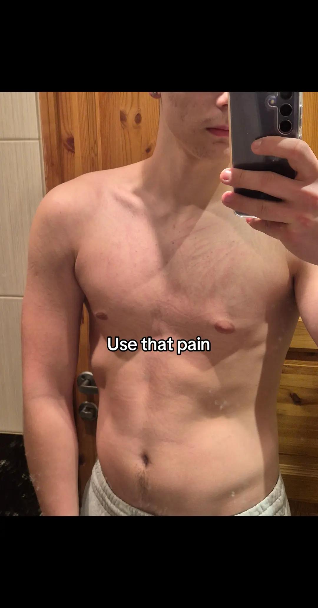 @Rasmussp