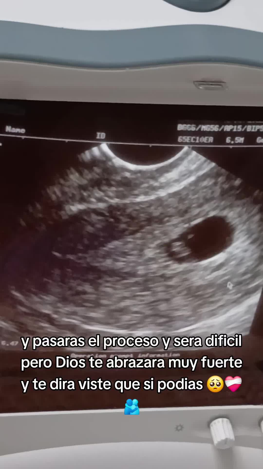 @🌸🍒la ni&ntilde;a👸🎀