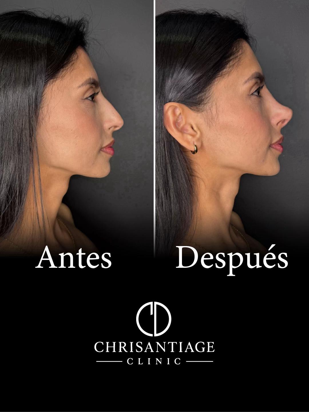 @chrisantiage