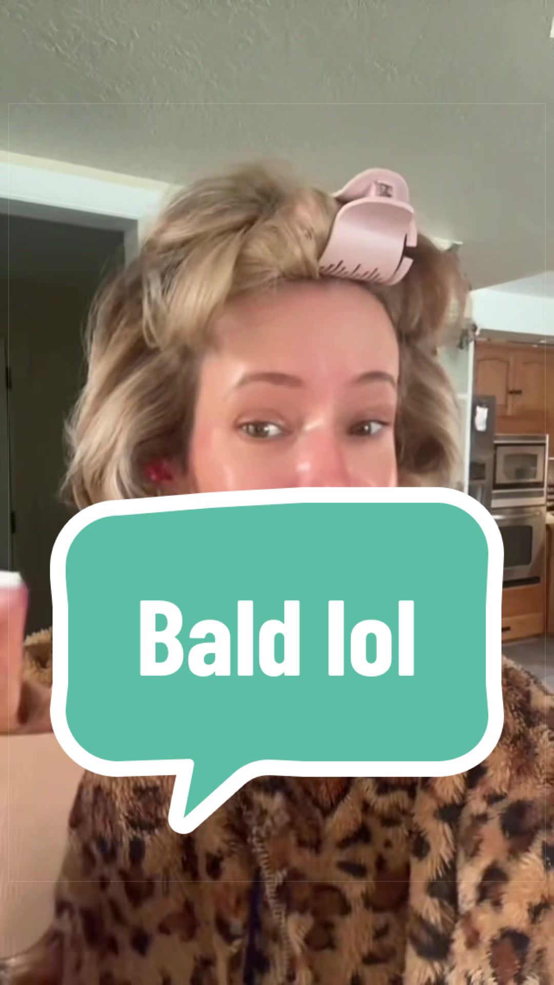@Ally K