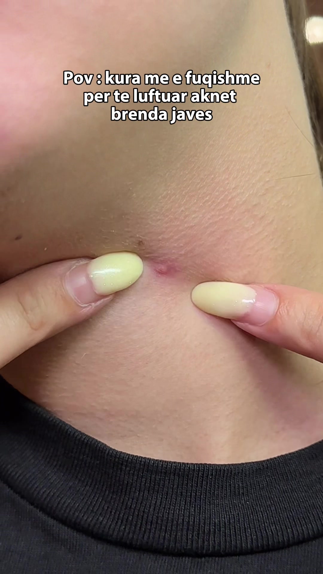 @Glowyskin.al