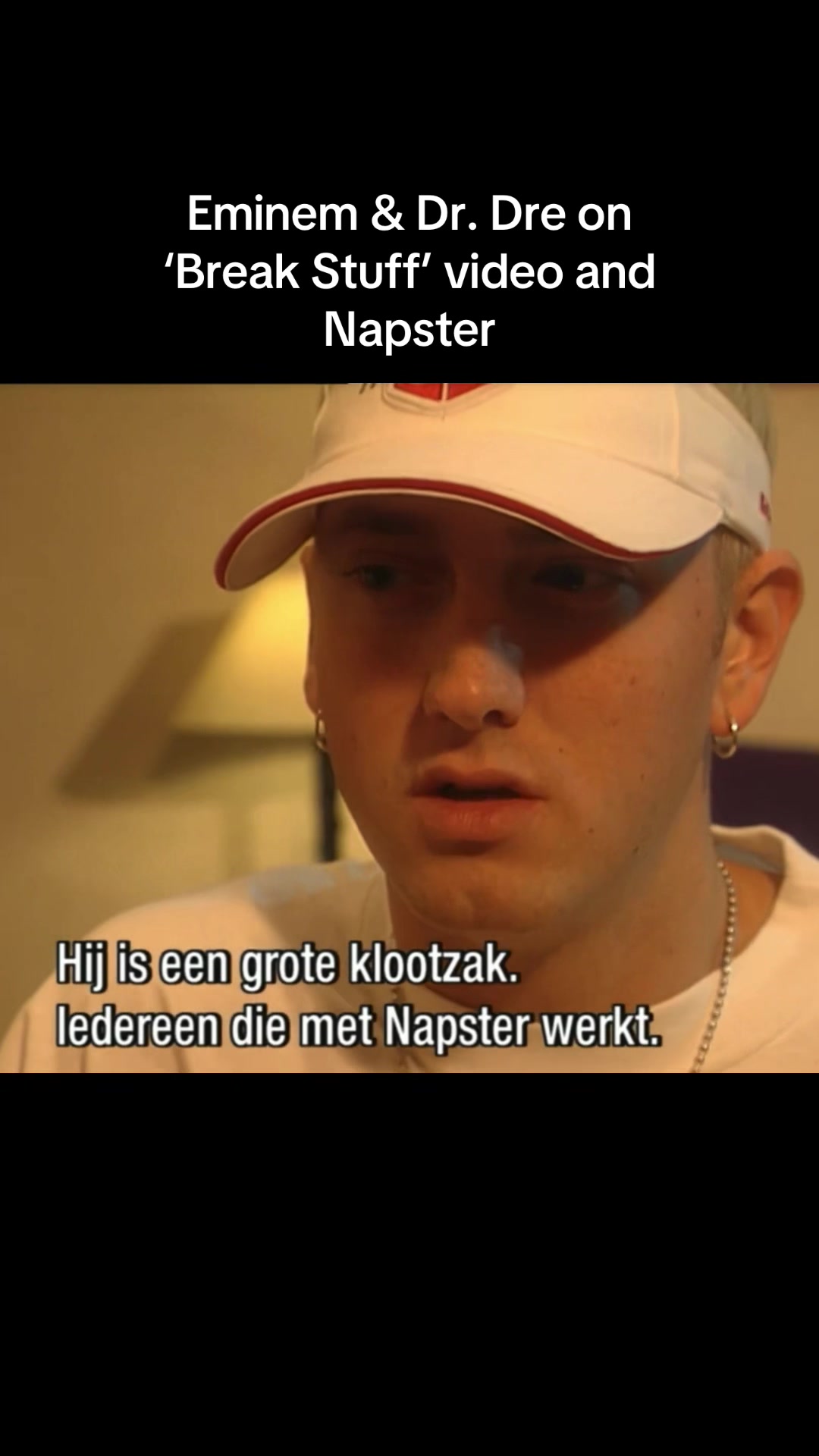 @Rare Limp Bizkit Videos