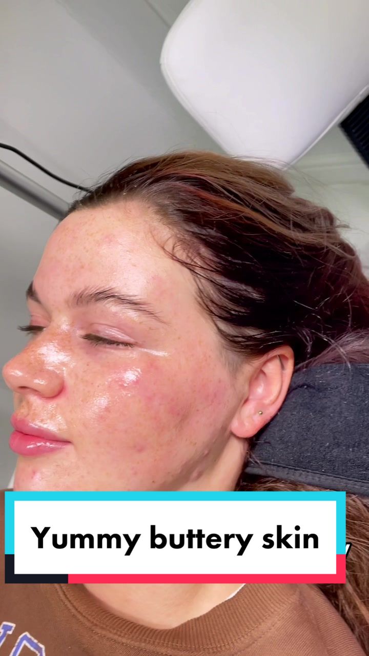 @Skinglowbysophie