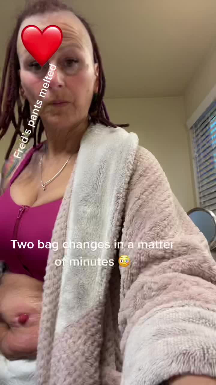 @IleostomyWarrior.Sher