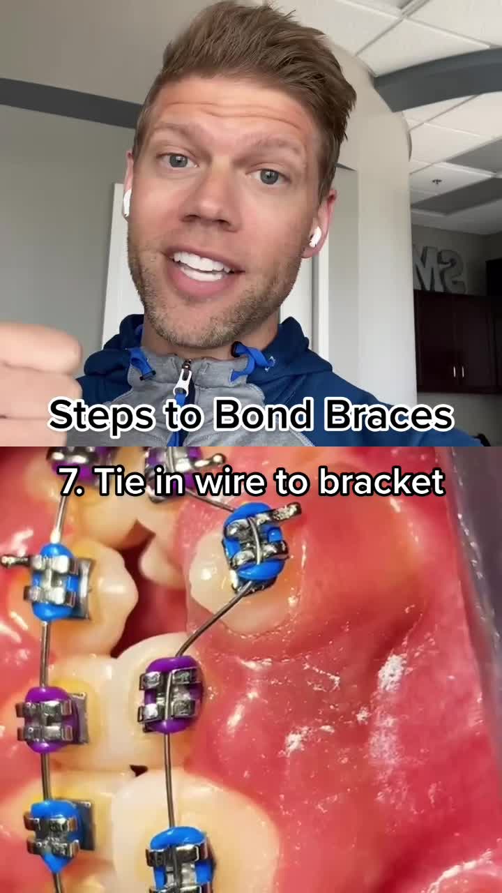 @The Braces Guy