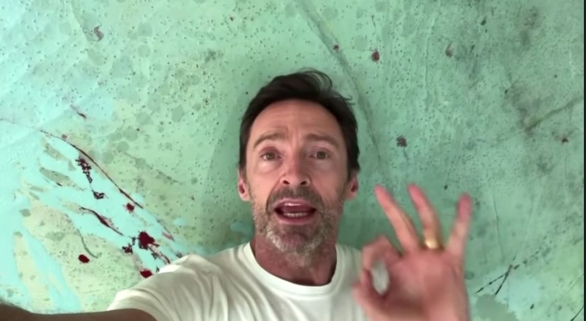 @Hugh Jackman