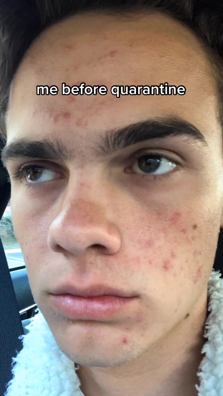 @Jake Clark
