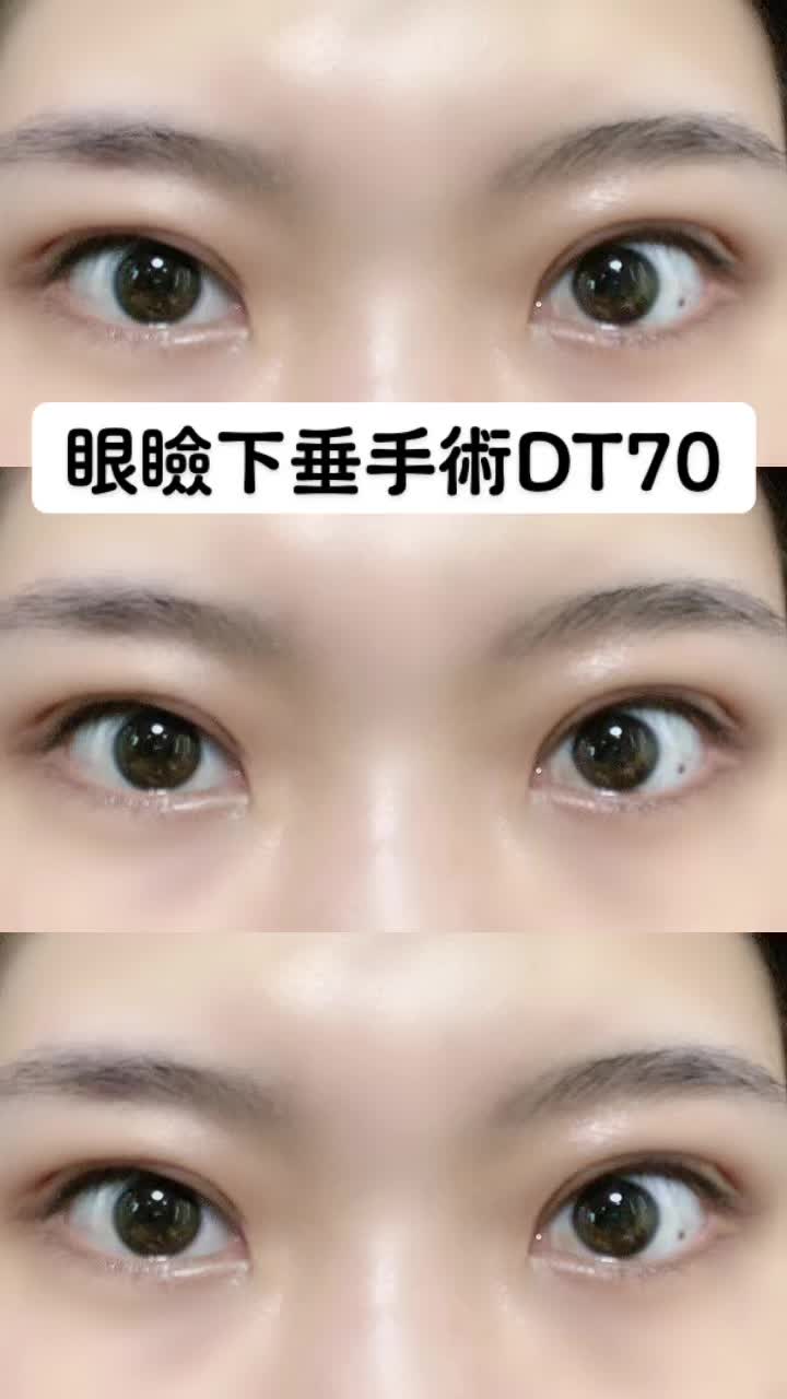 @igarashi