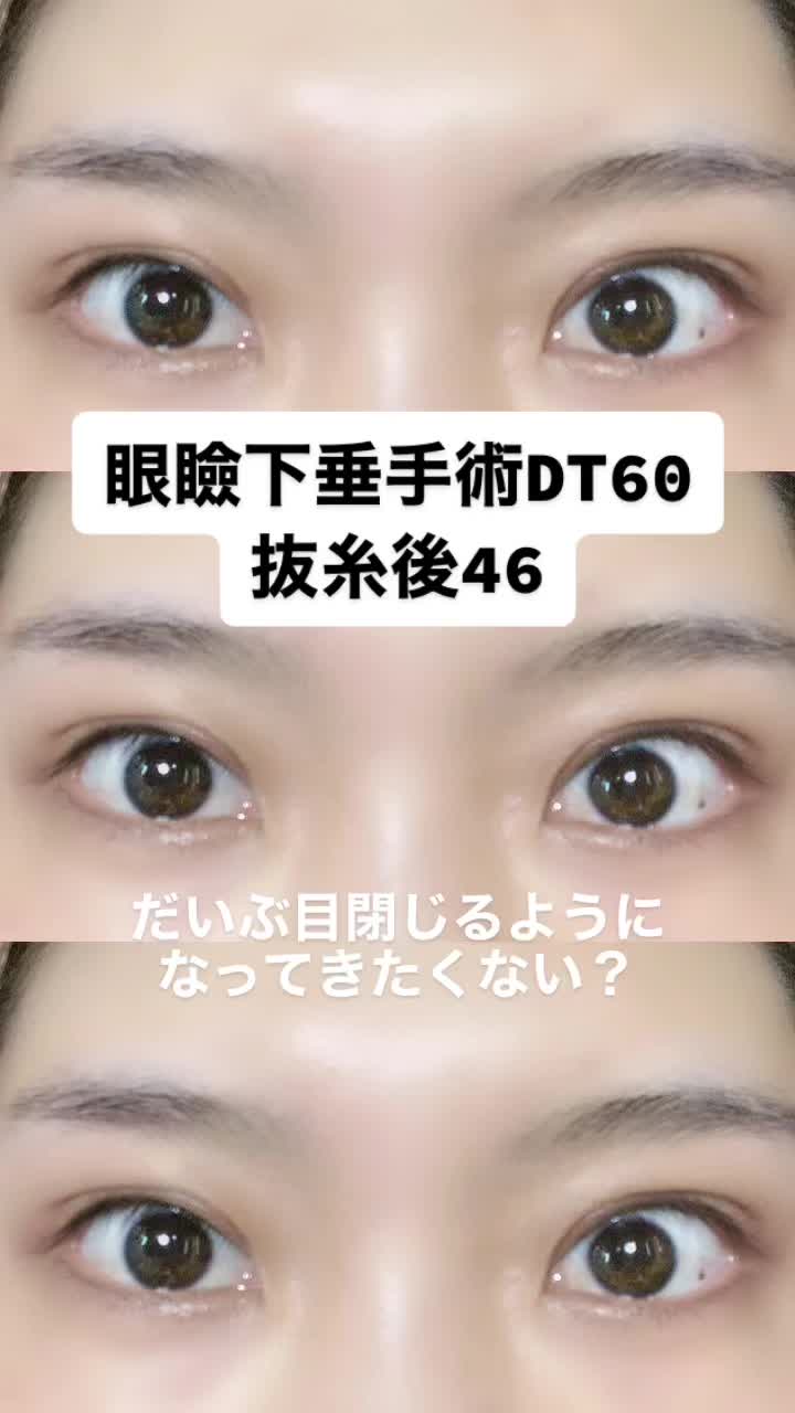 @igarashi