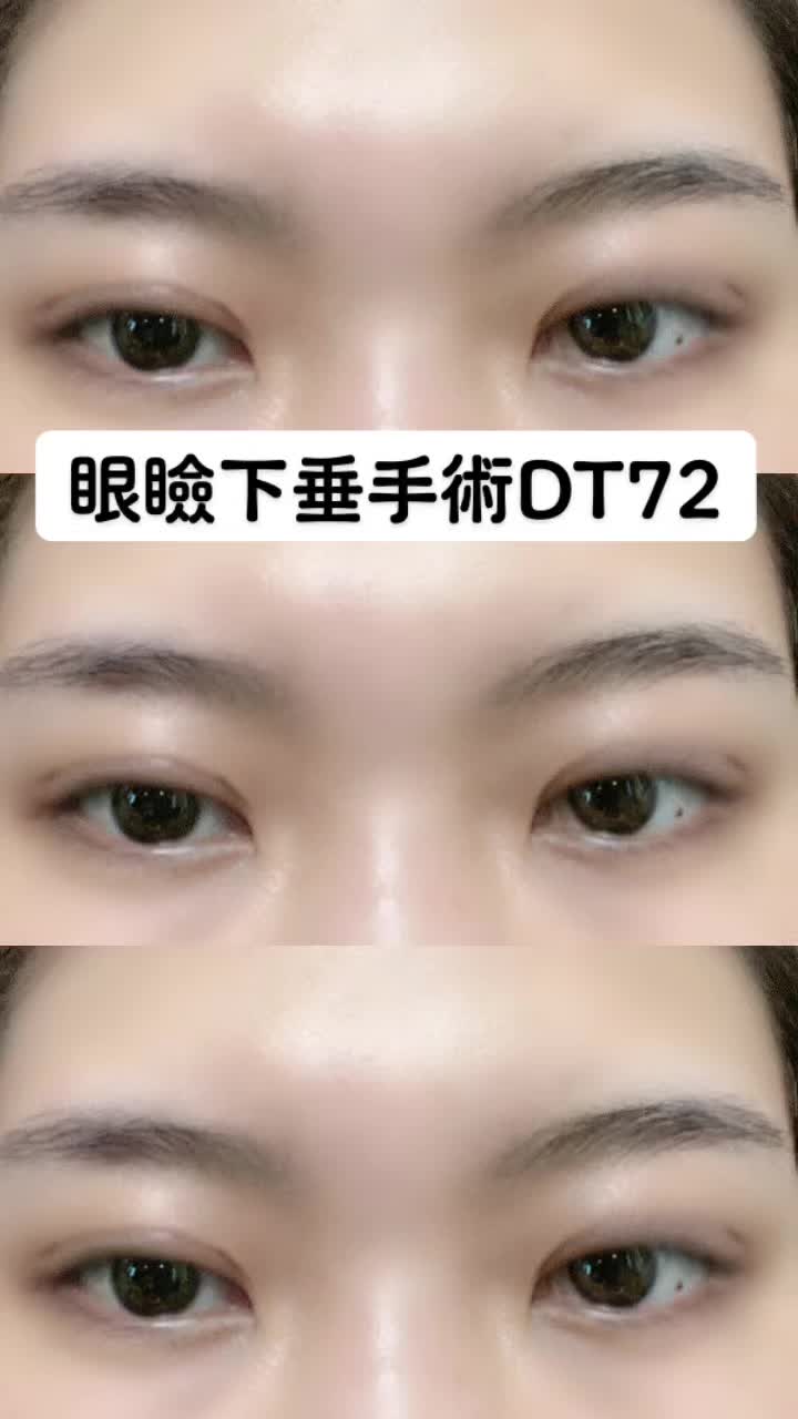 @igarashi