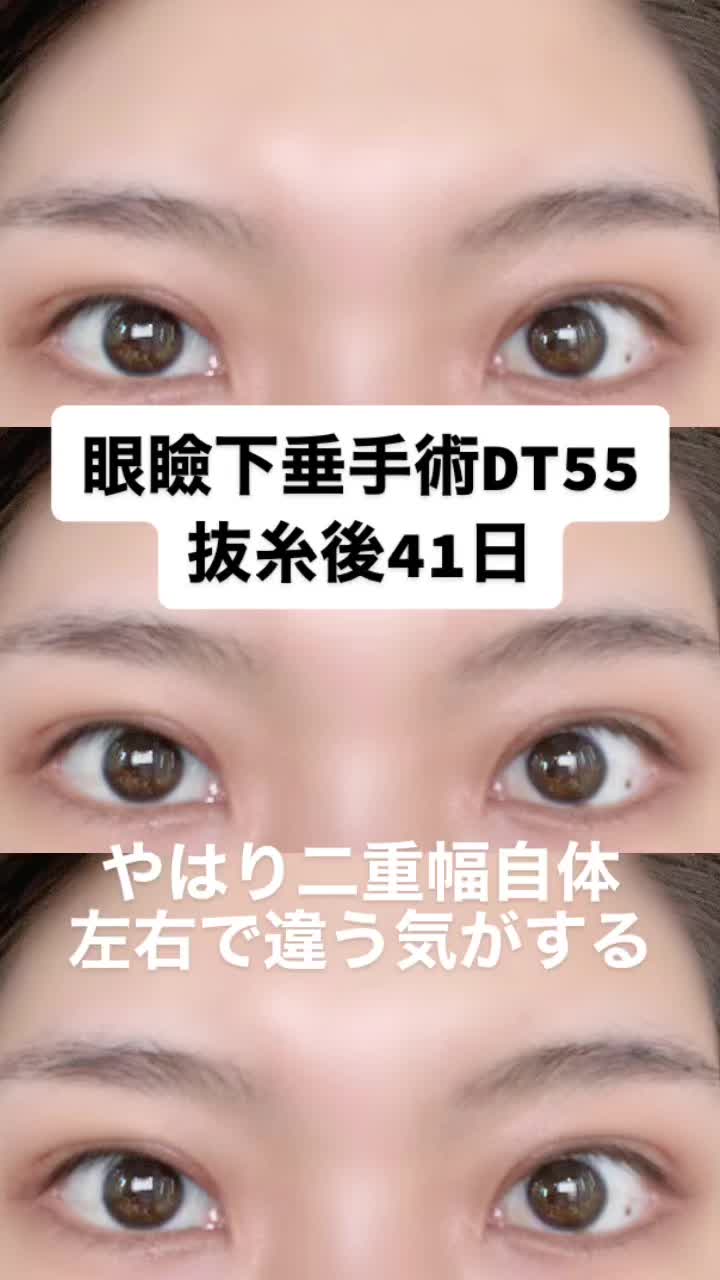 @igarashi