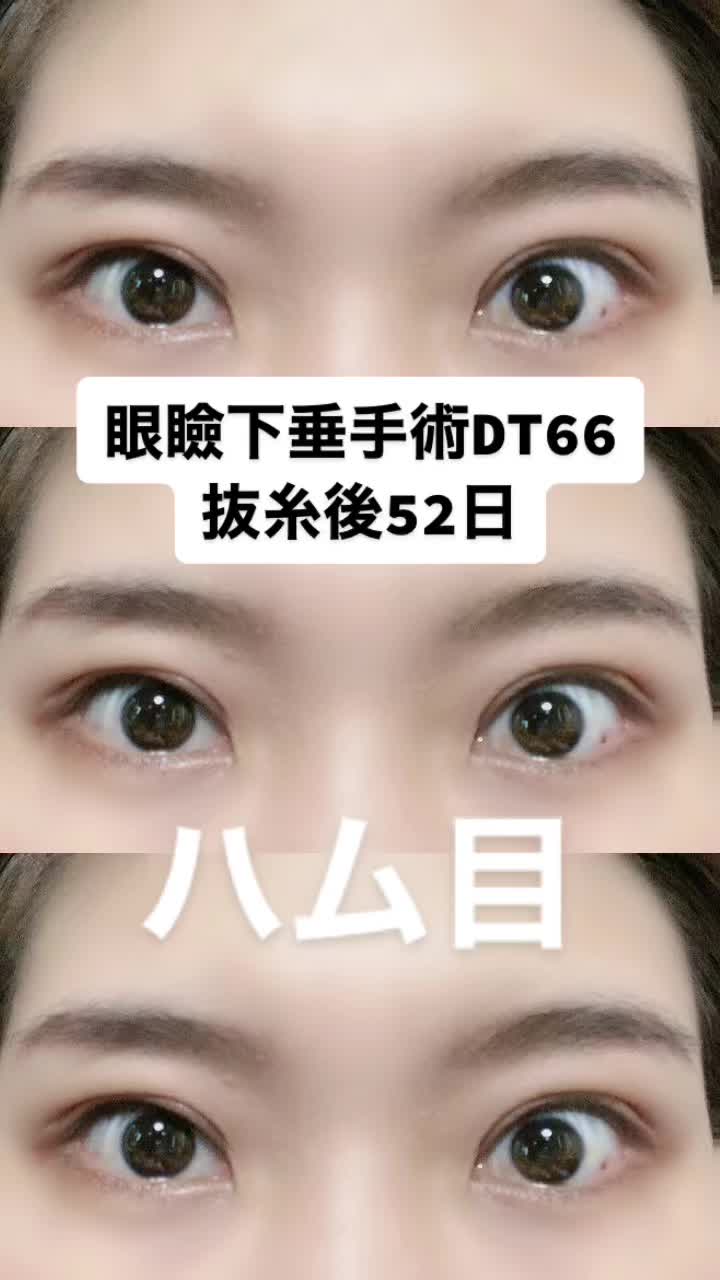 @igarashi