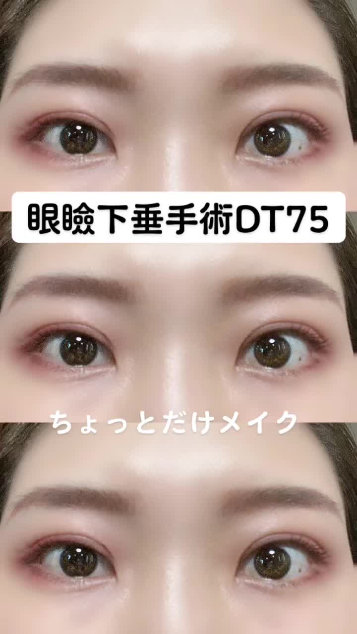 @igarashi