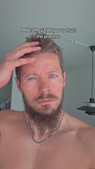 @Espen Hatleskog