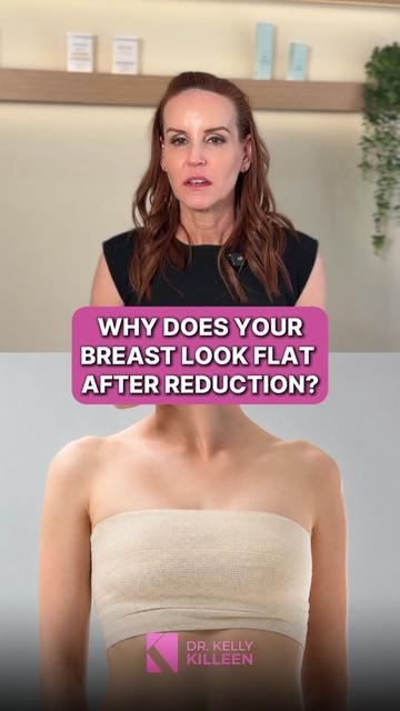 @Kelly&ensp;Killeen,&ensp;MD,&ensp;FACS