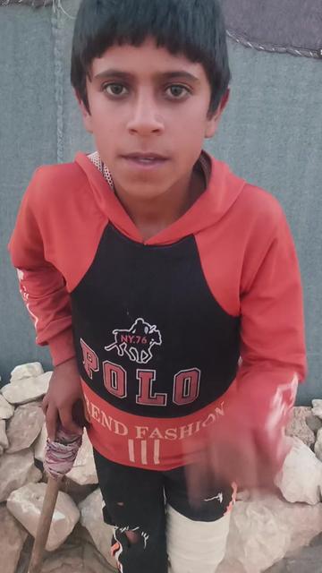 @Ali the amputee🇵🇸😭🥹