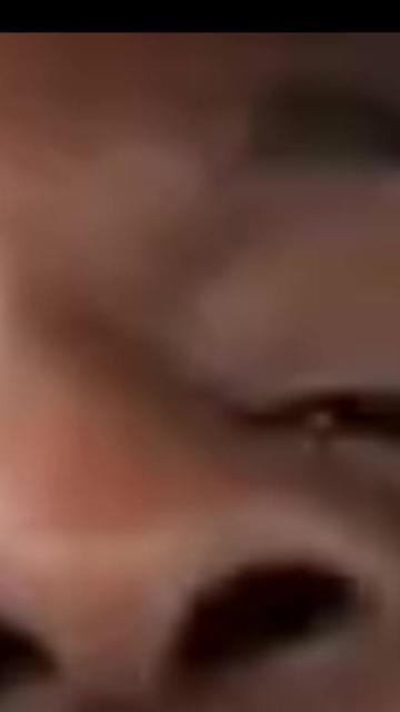 @osasioos.forehead