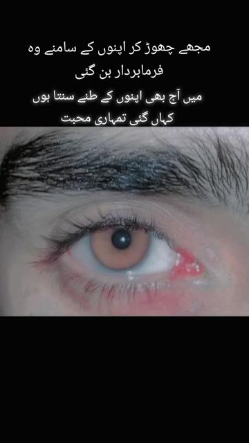 @AwAn ZaDA