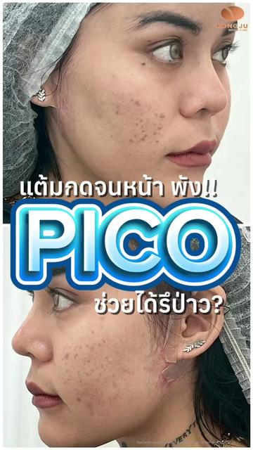 @กองจู พัทยา