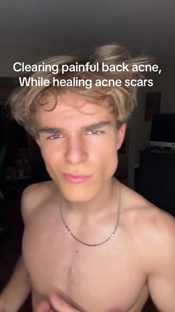 @Finn