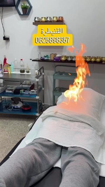 @Hijama.abdelmajid