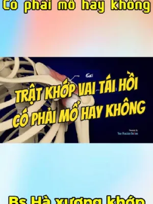 @Chuyên gia xương khớp