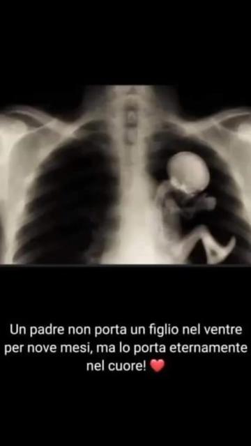 @ilmanu75