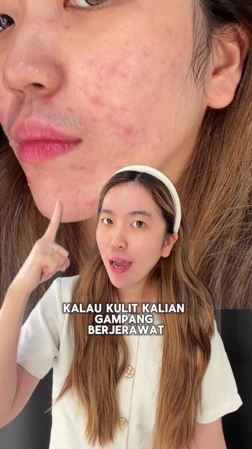 @JESS BANDIT