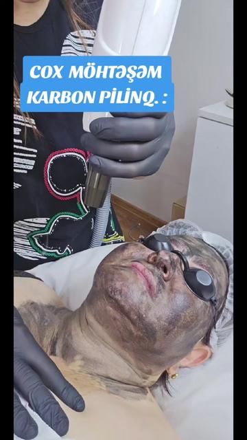 @ehmedli_kosmetoloq_lazeroloq