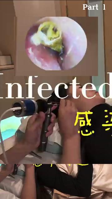 @ASMR Ear Cleaning