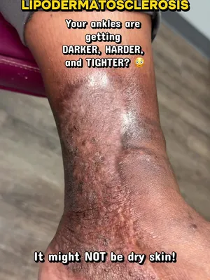 @Deniel Foot and Ankle Center