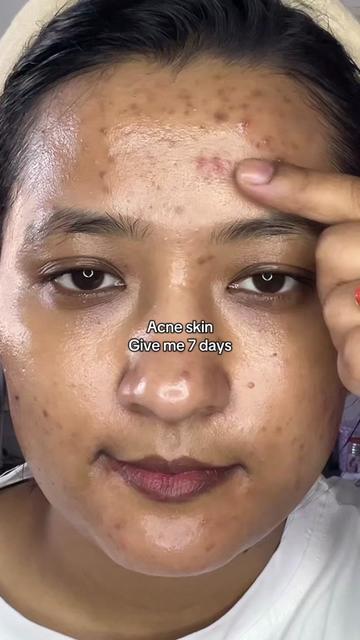 @Anuradha